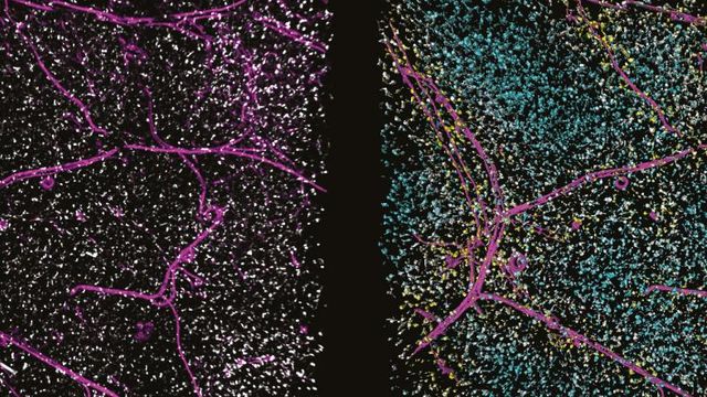 Accurately Analyze Fluorescent Widefield Images content piece image 