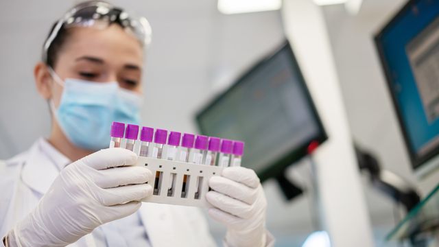 A scientist wearing a facemask, labcoat and white gloves and holds patient samples. 