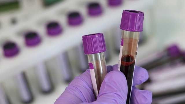 Two blood test vials held in a gloved hand. 