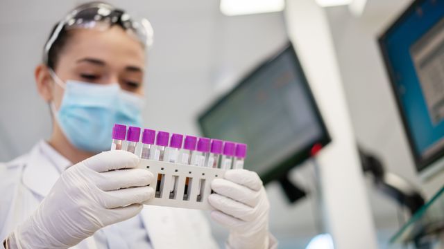 A scientist holding a rack of samples. 