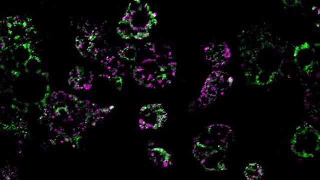The mitochondrial networks in fat cells, shown in pink and green fluorescence. 