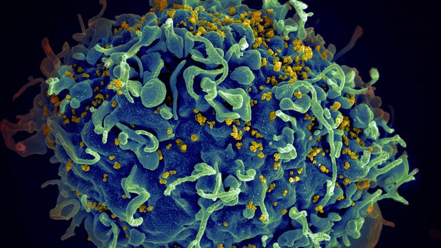 HIV attacking a human cell. 