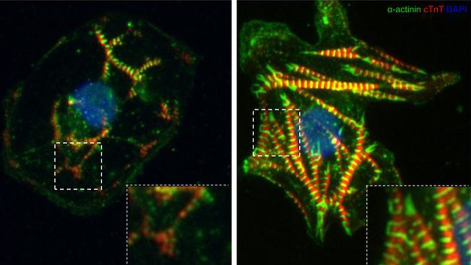 Treatment with ISRIB, a small molecule inhibitor of the integrated stress response, is cardioprotective against ponatinib.