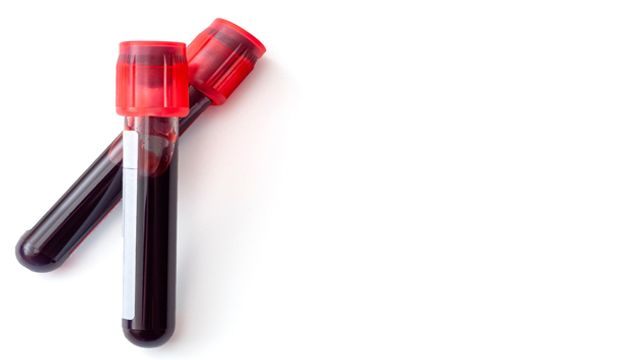 Two vials of blood. 